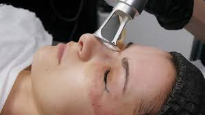 CO2 laser,fractional laser,CO2 fractional laser,Scar removal,skin rejuvenation