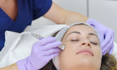 Are there any side effects of microneedling?